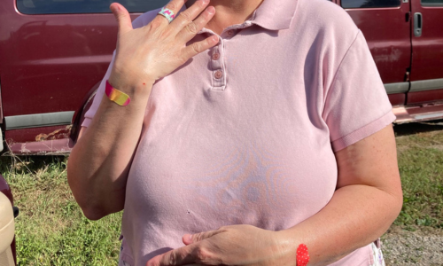 Woman showing bandages on her fingers and wrist from wild kitten scratches and bites while taming feral cats